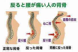 立川l反り腰 猫背l椎間関節性腰痛l鍼灸指圧マッサージ治療室ホスピターレ 鍼灸 不妊 美容鍼 治療室ホスピターレ 立川 昭島 日野 八王子 立川l反り腰 猫背l椎間関節性腰痛l鍼灸指圧マッサージ治療室ホスピターレ 鍼灸 不妊 美容鍼 治療室ホスピターレ 立川 昭島 日野 八王子