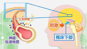 立川駅前の片頭痛（偏頭痛）l 鍼灸指圧マッサージ治療室ホスピターレ